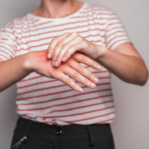 Anti Allergic/ Inflammatory