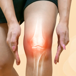 Osteoarthritis
